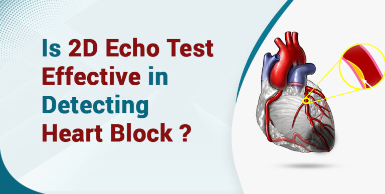 is-2d-echo-test-effective-in-detecting-heart-blockages